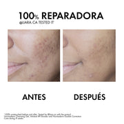 Vichy Normaderm Phytosolution Tratamiento Anti Imperfecciones 50Ml - Farmacias Arrocha