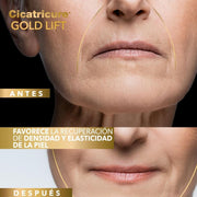 Cicatricure Gold Lift Dia - Farmacias Arrocha