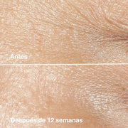 Clinique Crema Hidratante Smart Clinical Repair ™ Rich Antiarrugas 50 ml - Farmacias Arrocha