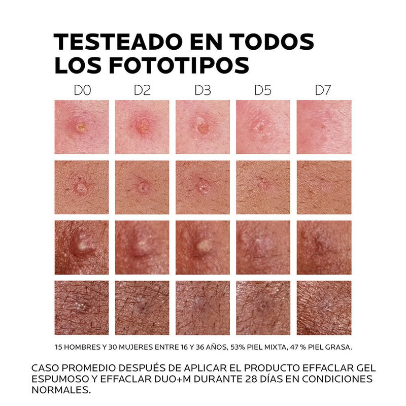 La Roche Posay Effaclar duo + M piel grasa 40ml - Farmacias Arrocha
