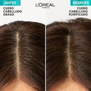 L'Oreal Elvive Tratamiento Hidra Hialurónico Pure 300 G - Farmacias Arrocha