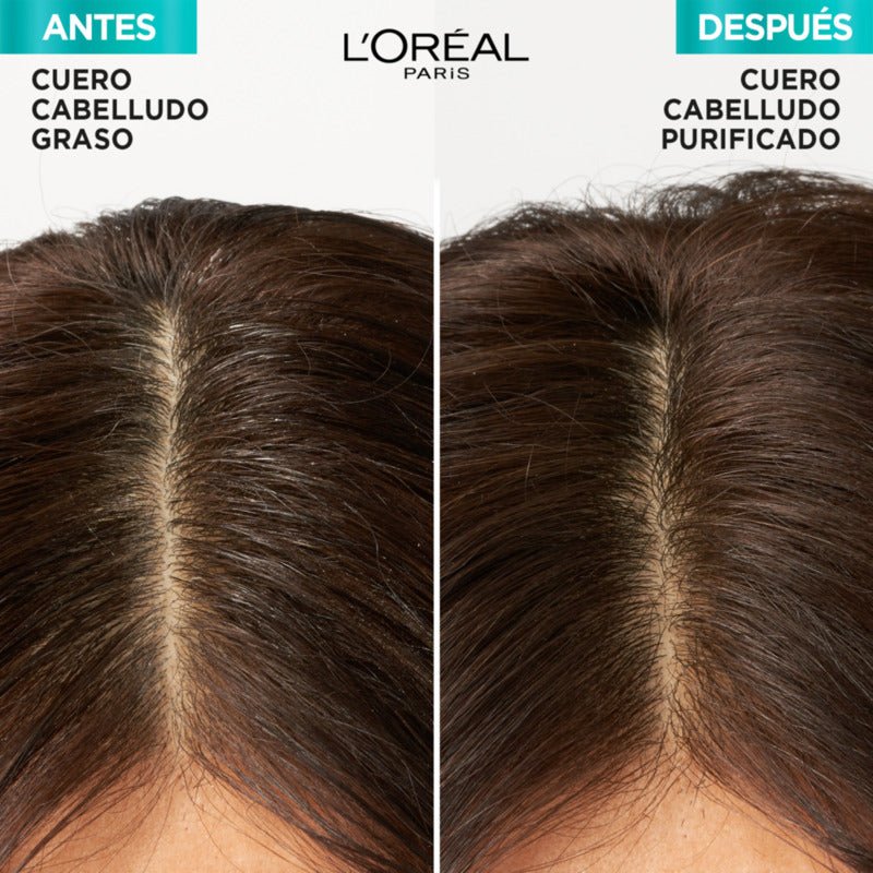 L'Oreal Elvive Tratamiento Hidra Hialurónico Pure 300 G - Farmacias Arrocha