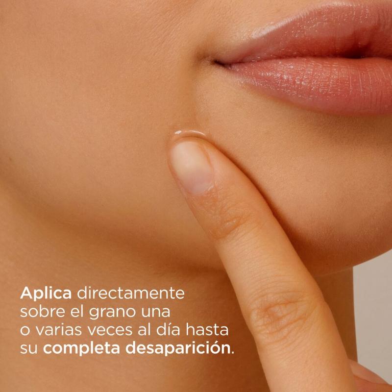 ISDIN Acniben on the Spot - Gel secante 15 ML - Farmacias Arrocha