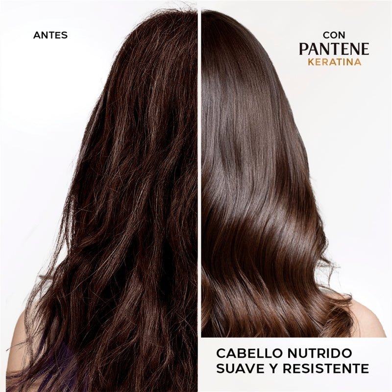 Shampoo Reparador Pantene Pro - v Miracles Keratina Repara Y Protege 300 ml - Farmacias Arrocha