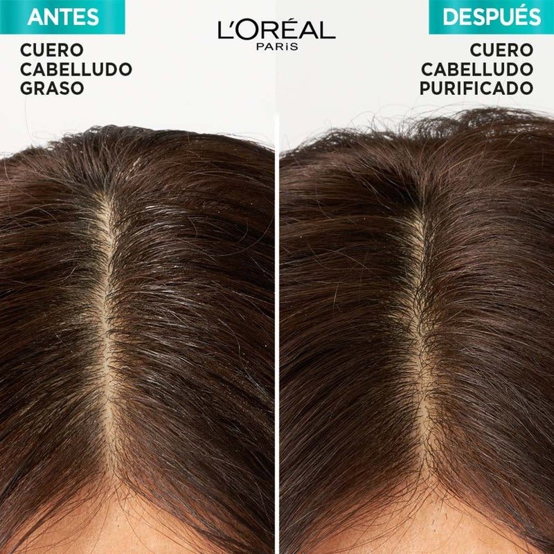 L'Oreal ElVive Shampoo Hidra Hialurónico Pure 370Ml - Farmacias Arrocha