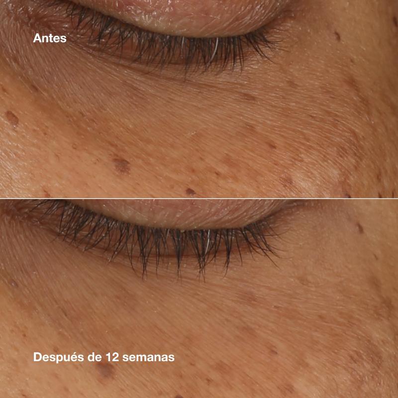 Clinique Suero concentrado All About Eyes™ Iluminador 10 ml - Farmacias Arrocha