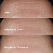 Clinique Suero Hidratante Smart Clinical Repair ™ Antiarrugas 10 Ml - Farmacias Arrocha