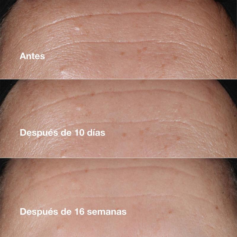Clinique Suero Hidratante Smart Clinical Repair ™ Antiarrugas 10 Ml - Farmacias Arrocha
