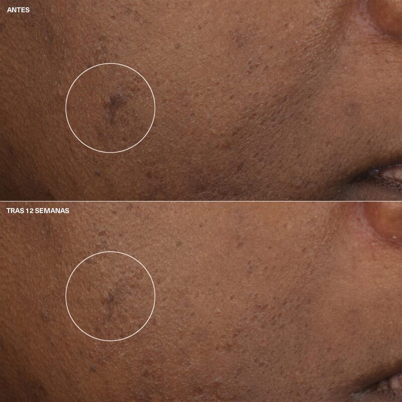 Clinique Crema Hidratante Even Better Clinical™ Antimanchas 15 ml - Farmacias Arrocha