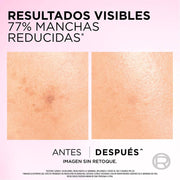 Sérum Facial L'Oréal Paris Glycolic Bright antimanchas Ácido Glicólico y Niacinamida 30 - Farmacias Arrocha